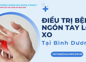 Điều trị bệnh Ngón Tay Lò Xo tại Bình Dương