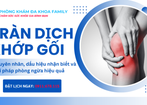 Tràn dịch khớp gối: Nguyên nhân, dấu hiệu nhận biết và giải pháp phòng ngừa hiệu quả